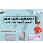 What is medical abortion and how does it work? - Sell advertisement in Dallas